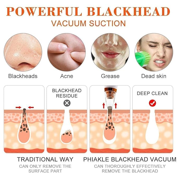 Helothera DermaCleanse – For Clear, Smooth Skin