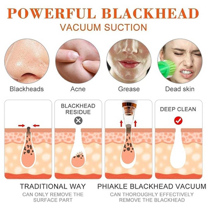 Helothera DermaCleanse – For Clear, Smooth Skin